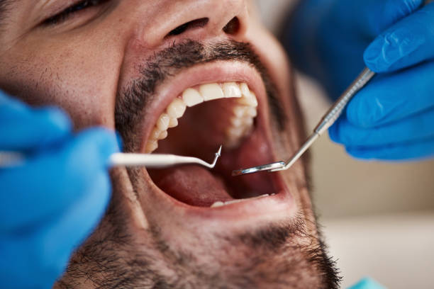 Best Emergency Tooth Extraction in Rome, IL